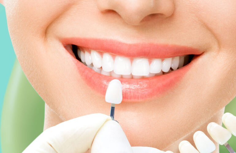 Simyadent lamine protez kaplama estetik diş hekimliği beyaz dişler zirkonyum