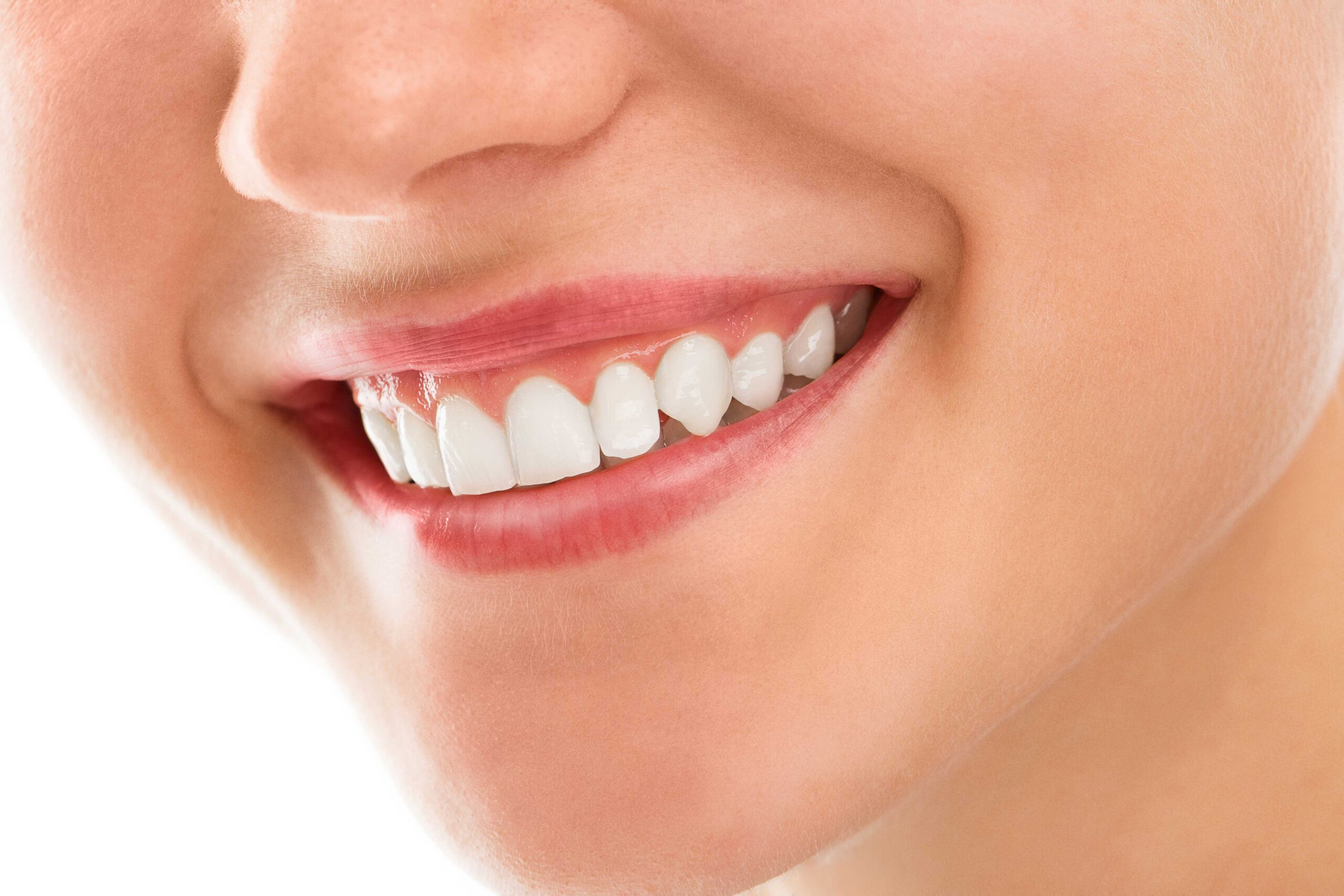 Diş Estetik Simyadent Lamine Dişeti sağlığı